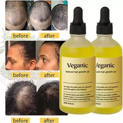 Vegan Natural Hair Growth Oil Buy 1 Get 1 Free |  Natural Hair Growth Serum | 120 ML Bottle | Growth Oil for Thicker Locks